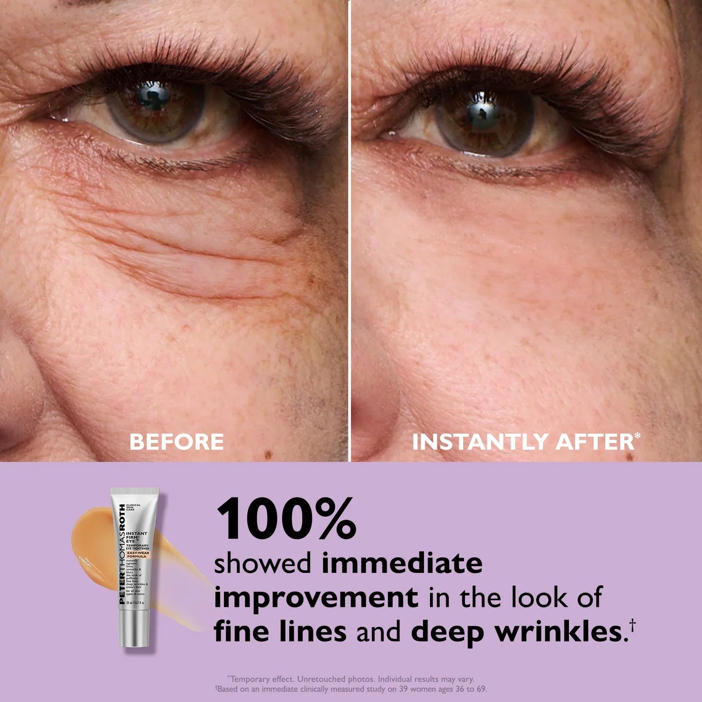 Instant Face Tightener